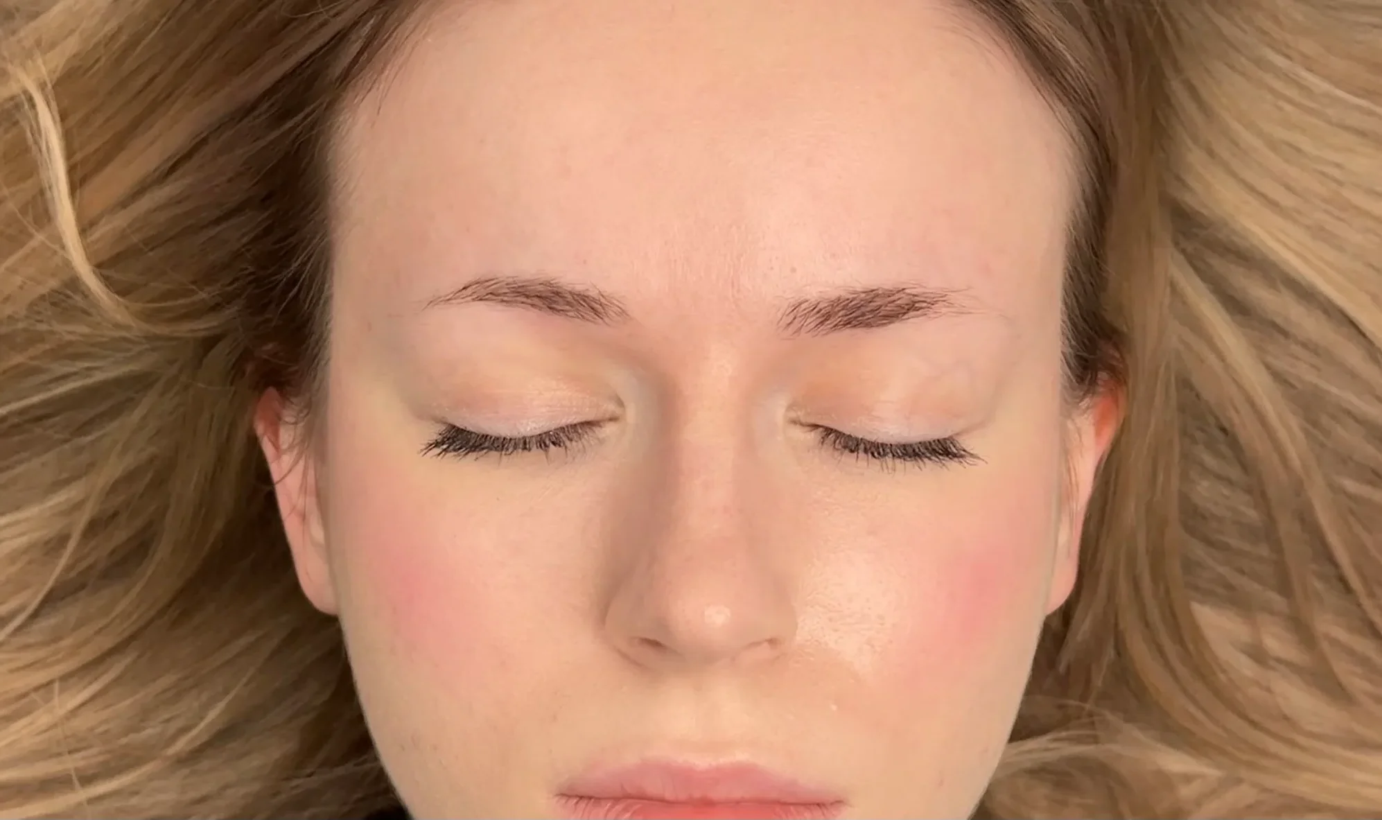 Częsty przypadek z gabinetu: zanik lub brak końcówek brwi